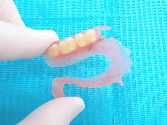 ノンクラスプデンチャー